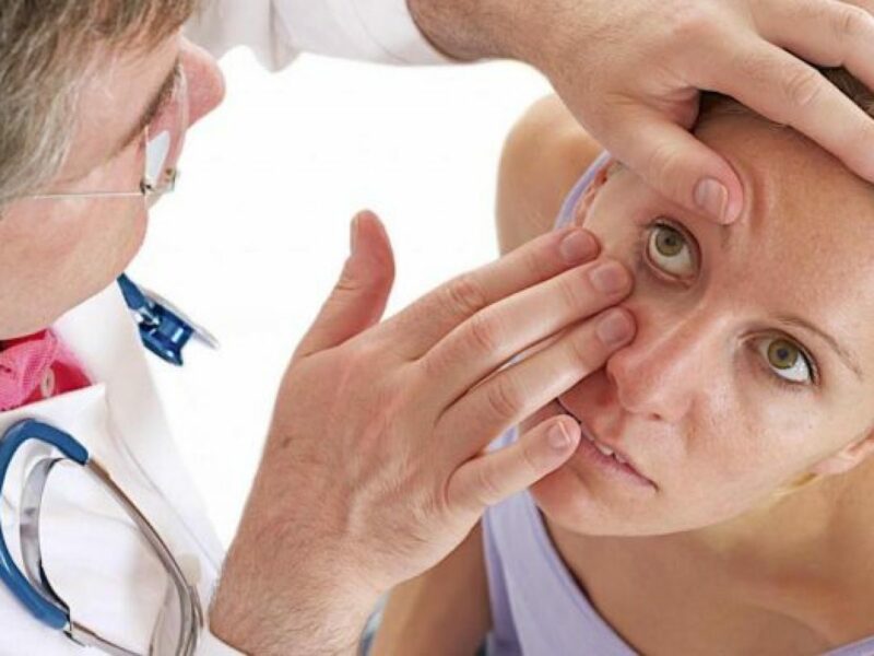 Comprehensive Guide on How CBD Can Treat Conjunctivitis